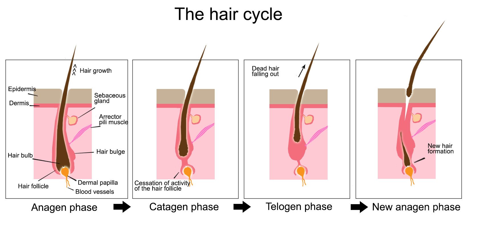 hair follicle removal